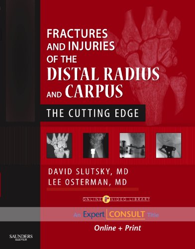 Fractures and Injuries of the Distal Radius and Carpus