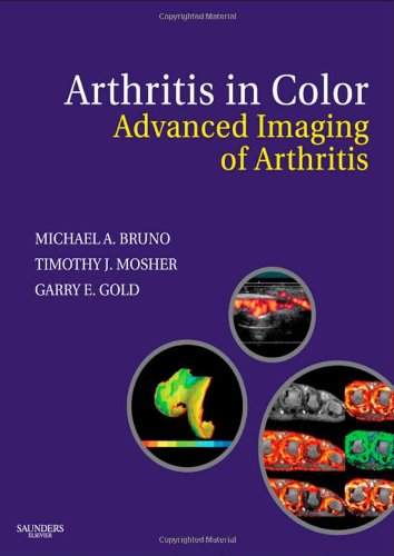Arthritis in Color