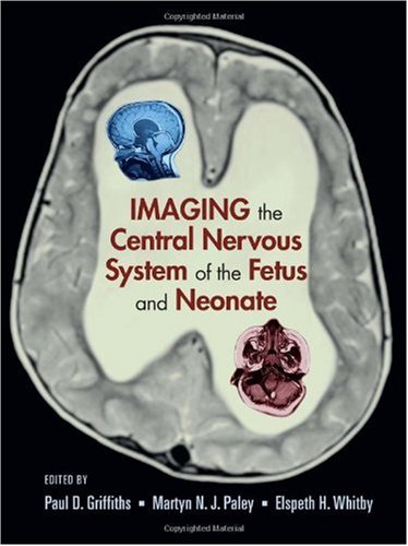 Imaging the Central Nervous System of the Fetus and Neonate