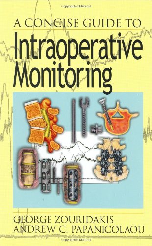 A Concise Guide to Intraoperative Monitoring