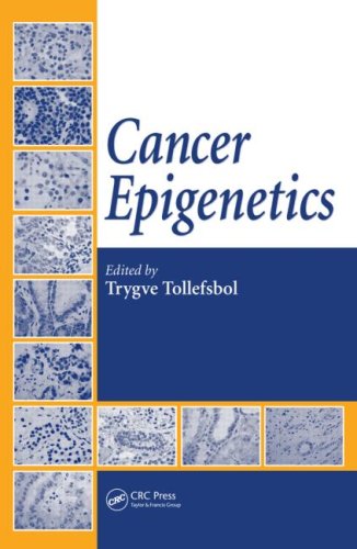 Cancer epigenetics