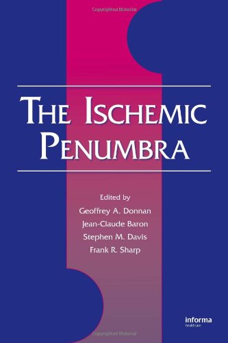 The Ischemic Penumbra