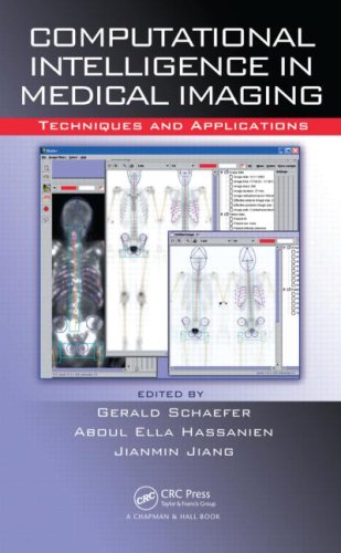 Computational Intelligence in Medical Imaging