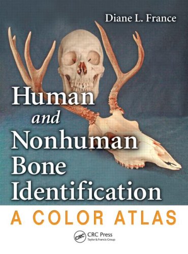 Human and Nonhuman Bone Identification