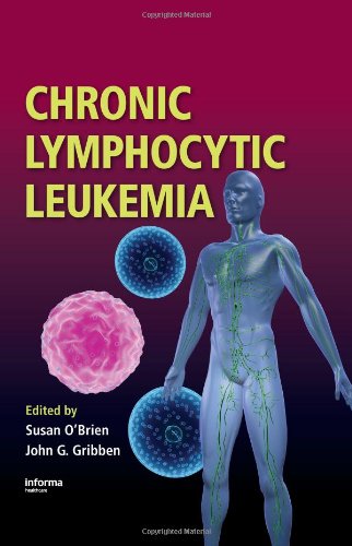 Chronic Lymphocytic Leukemia