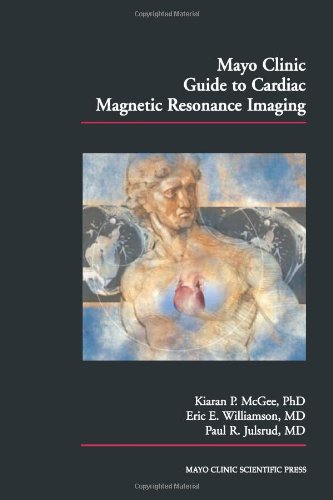 Mayo Clinic Guide to Cardiac Magnetic Resonance Imaging