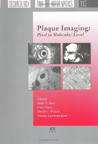 Plaque Imaging