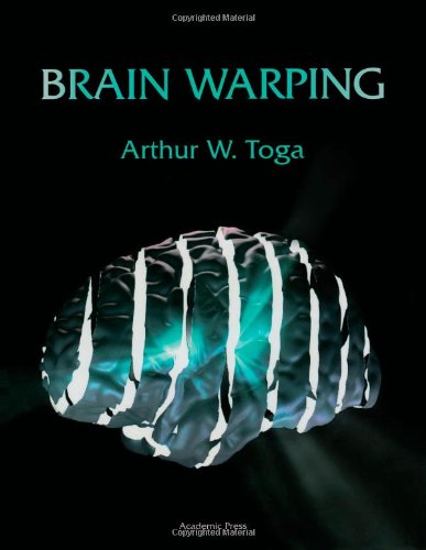 Brain warping