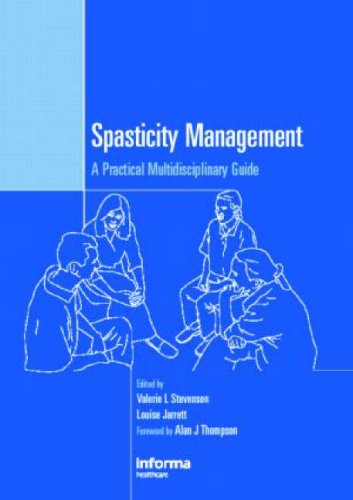 Spasticity Management