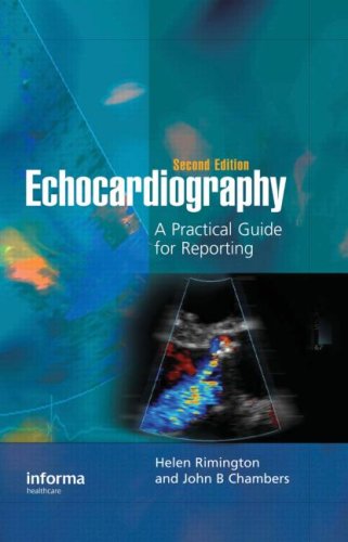 Echocardiography