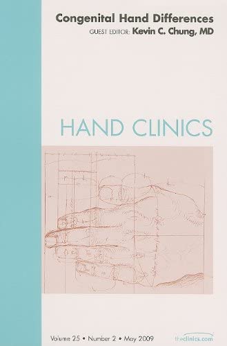 Hand Clinics, Vol. 25, No. 2: Congenital Hand Differences