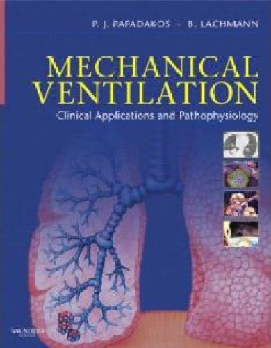 Mechanical Ventilation E-Book