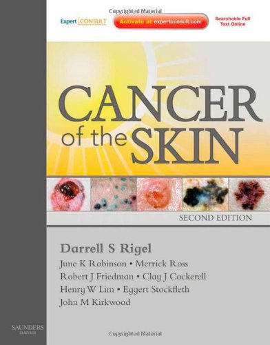 Cancer of the Skin