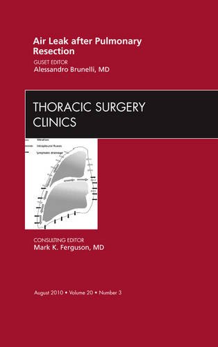 Air Leak After Pulmonary Resection, an Issue of Thoracic Surgery Clinics, 20