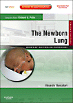 The Newborn Lung