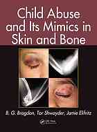 Child abuse and its mimics in skin and bone