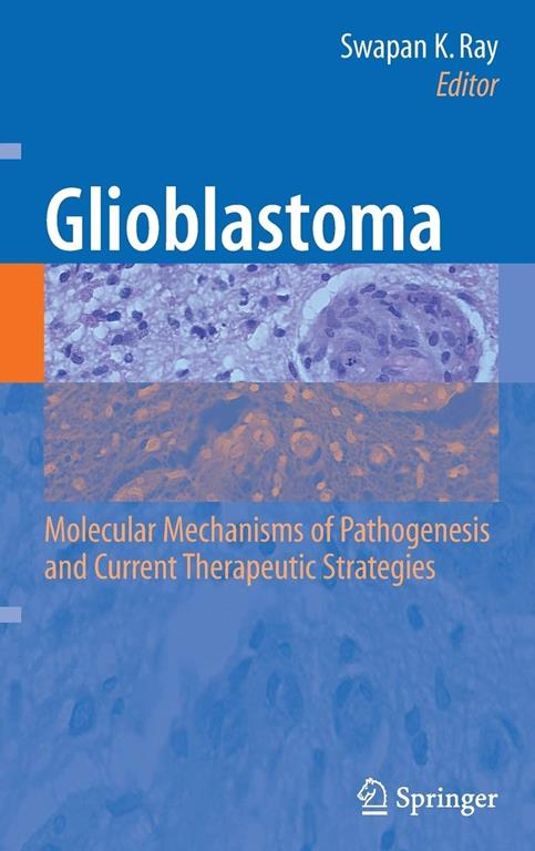 Glioblastoma/ Molecular Mechanisms Of Pathogenesis And Current Therapeutic Strategies