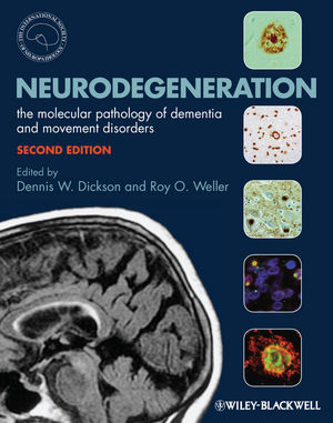 Neurodegeneration : the molecular pathology of dementia and movement disorders