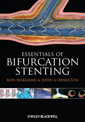 Bifurcation stenting