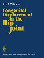 Congenital displacement of the hip joint