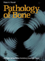 Pathology of Bone.