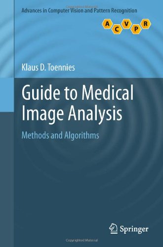 Guide to Medical Image Analysis