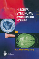 Hughes syndrome : antiphospholipid syndrome