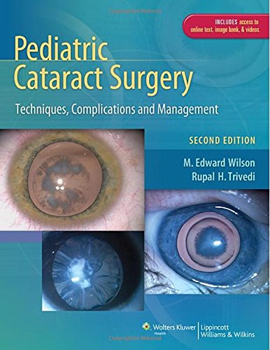 Pediatric Cataract Surgery