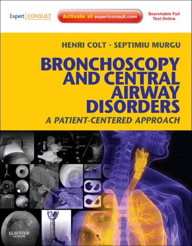 Bronchoscopy and Central Airway Disorders E-Book