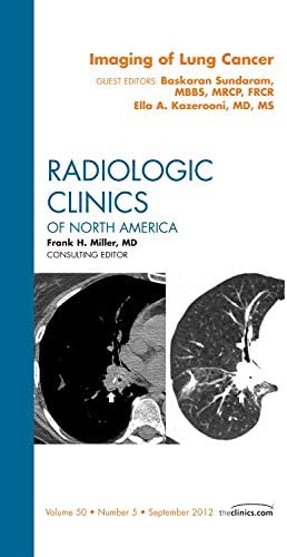 Imaging of Lung Cancer, An Issue of Radiologic Clinics of North America (Volume 50-5) (The Clinics: Radiology, Volume 50-5)