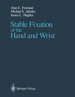 Stable Fixation of the Hand and Wrist.