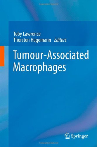 Tumour-Associated Macrophages