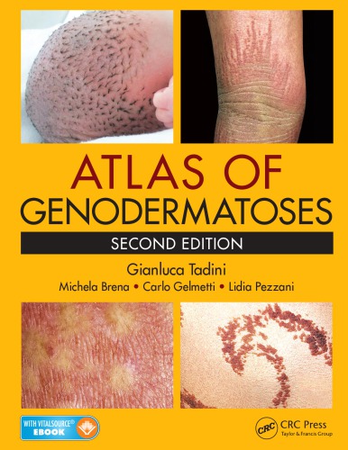 Atlas of genodermatoses