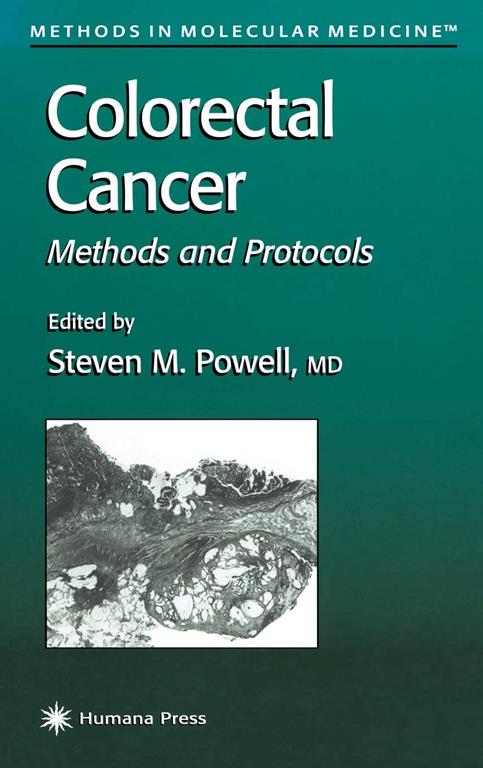 Colorectal Cancer: Methods and Protocols (Methods in Molecular Medicine, 50)