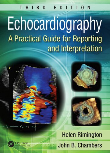 Echocardiography : a practical guide for reporting and interpretation