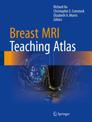 Breast MRI Teaching Atlas