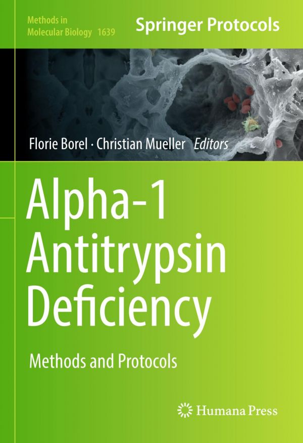 Alpha-1 Antitrypsin Deficiency Methods and Protocols