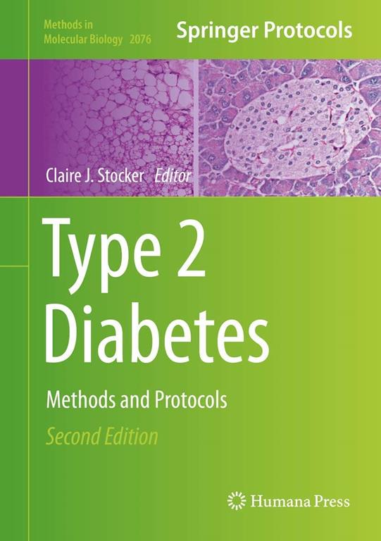 Type 2 Diabetes