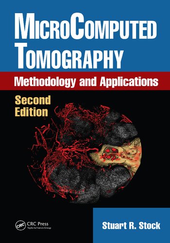 Microcomputed Tomography