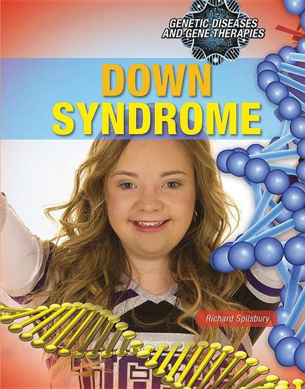 Down Syndrome (Genetic Diseases and Gene Therapies)