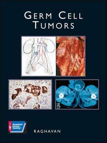 Germ Cell Tumors (ACS ATLAS OF CLINICAL ONCOLOGY)