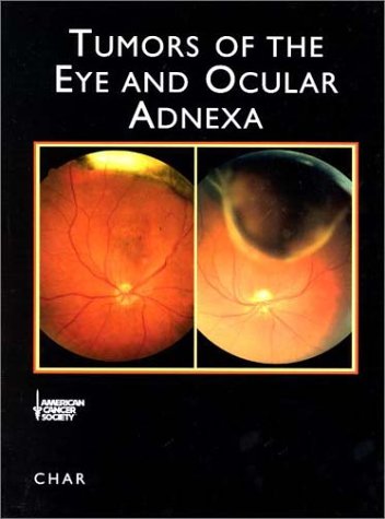 Tumors of the Eye and Ocular Adnexa (Atlas of Clinical Oncology)