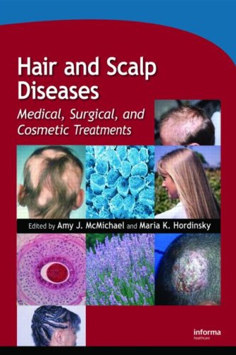 Hair And Scalp Diseases