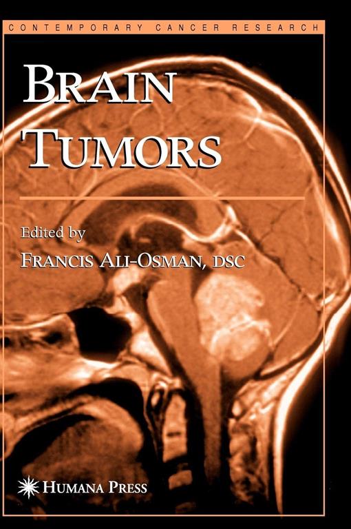 Brain Tumors (Contemporary Cancer Research) (Contemporary Cancer Research)