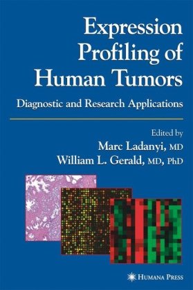 Expression Profiling of Human Tumors