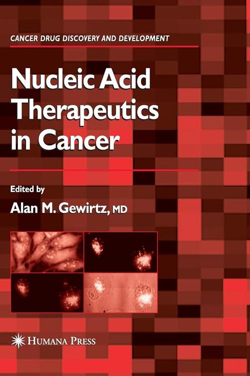 Nucleic Acid Therapeutics in Cancer