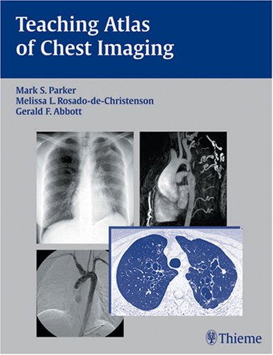 Teaching Atlas of Chest Imaging