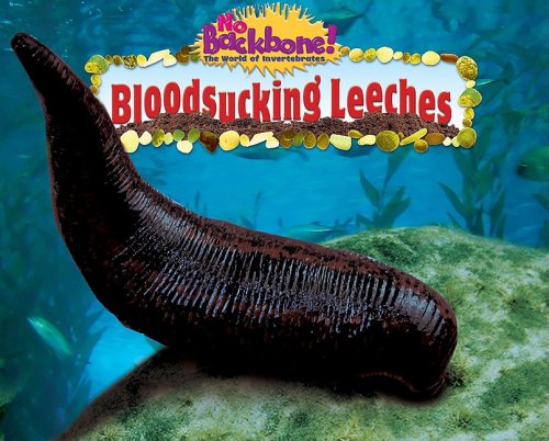 Bloodsucking Leeches