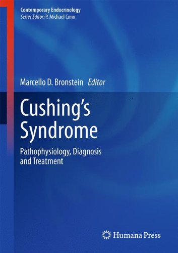 Cushing's Syndrome Pathophysiology, Diagnosis and Treatment