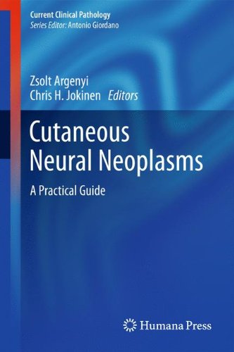 Cutaneous Neural Neoplasms A Practical Guide